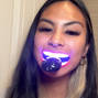 a girl applying teeth whitening kit